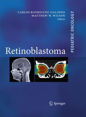Wilson / Rodriguez Galindo |  Retinoblastoma | Buch |  Sack Fachmedien