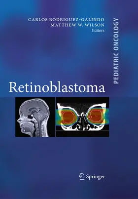 Rodriguez Galindo / Wilson / Chévez-Barrios |  Retinoblastoma | eBook | Sack Fachmedien