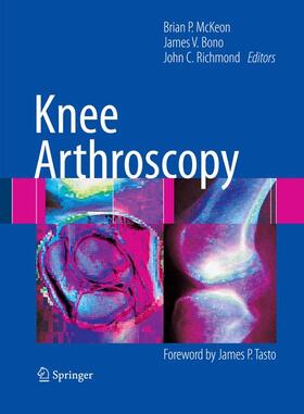 McKeon / Richmond / Bono |  Knee Arthroscopy | Buch |  Sack Fachmedien