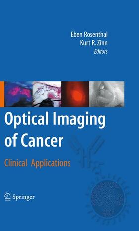 Rosenthal / Zinn |  Optical Imaging of Cancer | Buch |  Sack Fachmedien