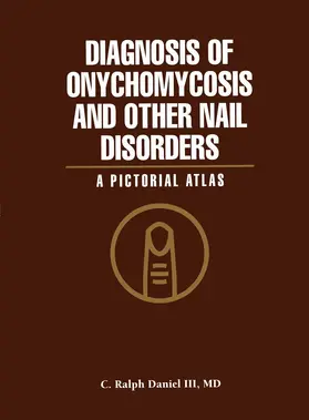 Daniel |  Diagnosis of Onychomycosis and Other Nail Disorders | Buch |  Sack Fachmedien