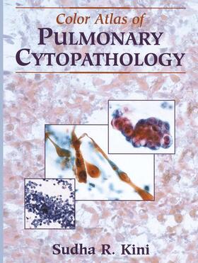 Kini |  Color Atlas of Pulmonary Cytopathology | Buch |  Sack Fachmedien