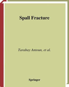 Antoun / Seaman / Utkin |  Spall Fracture | Buch |  Sack Fachmedien