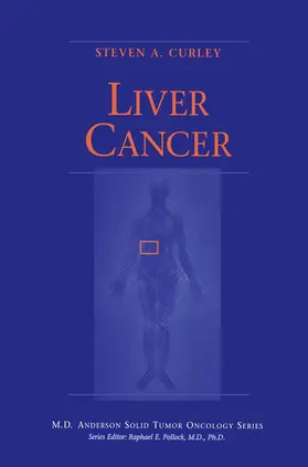 Curley |  Liver Cancer | Buch |  Sack Fachmedien