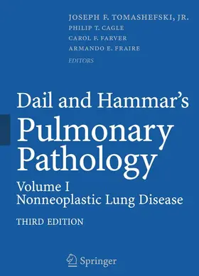 Tomashefski |  Dail and Hammar's Pulmonary Pathology | Buch |  Sack Fachmedien