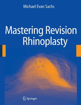 Sachs |  Mastering Revision Rhinoplasty | Buch |  Sack Fachmedien