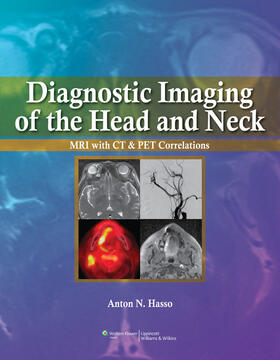Hasso |  Diagnostic Imaging of the Head and Neck | Buch |  Sack Fachmedien