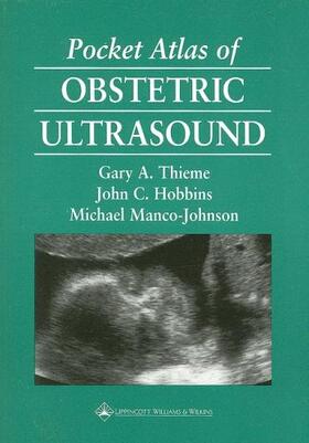 Thieme / Hobbins / Manco-Johnson |  Pocket Atlas of Obstetric Ultrasound | Buch |  Sack Fachmedien