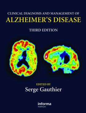 Gauthier |  Clinical Diagnosis and Management of Alzheimer's Disease | Buch |  Sack Fachmedien