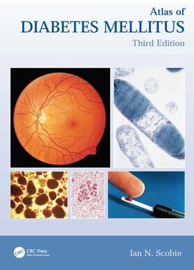 Scobie |  Atlas of Diabetes Mellitus | Buch |  Sack Fachmedien