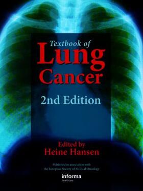 Hansen |  Textbook of Lung Cancer | Buch |  Sack Fachmedien