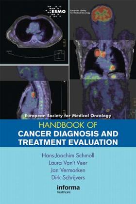 Schmoll / Van't Meer / Vermorken |  ESMO Handbook of Cancer Diagnosis and Treatment Evaluation | Buch |  Sack Fachmedien