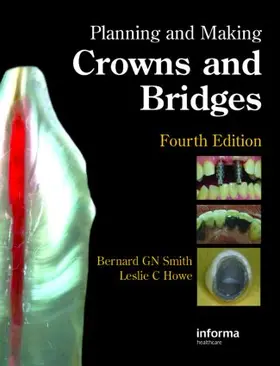 Smith / Howe |  Planning and Making Crowns and Bridges | Buch |  Sack Fachmedien