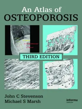 Stevenson / Marsh |  An Atlas of Osteoporosis | Buch |  Sack Fachmedien