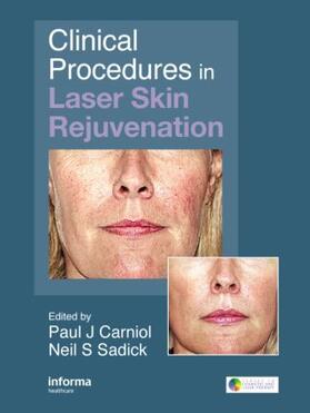 Carniol / Sadick |  Clinical Procedures in Laser Skin Rejuvenation | Buch |  Sack Fachmedien