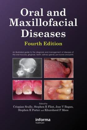 Scully / Flint |  Oral and Maxillofacial Diseases, Fourth Edition | Buch |  Sack Fachmedien