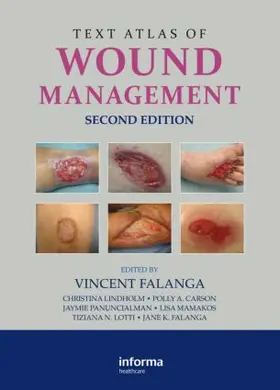 Falanga / Lindholm / Carson |  Text Atlas of Wound Management | Buch |  Sack Fachmedien