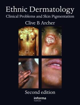 Archer |  Ethnic Dermatology | Buch |  Sack Fachmedien