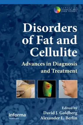 Goldberg / Berlin | Disorders of Fat and Cellulite | Buch | 978-0-415-47700-0 | sack.de