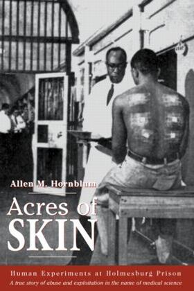 Hornblum |  Acres of Skin | Buch |  Sack Fachmedien