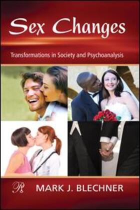 Blechner |  Sex Changes | Buch |  Sack Fachmedien