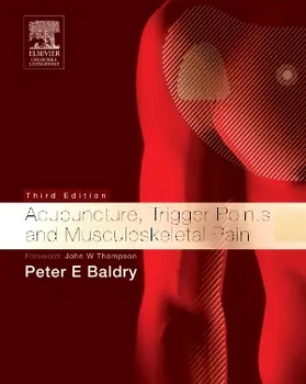 Baldry |  Acupuncture, Trigger Points and Musculoskeletal Pain | Buch |  Sack Fachmedien