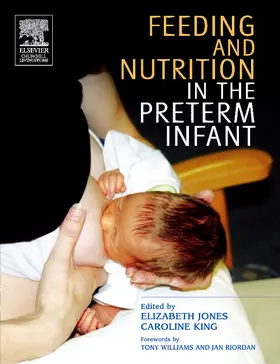 Jones / King |  Feeding and Nutrition in the Preterm Infant | Buch |  Sack Fachmedien