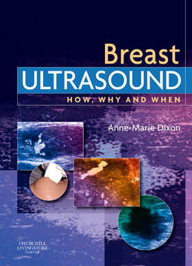 Dixon |  Breast Ultrasound | Buch |  Sack Fachmedien