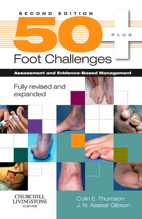 Thomson / Gibson |  50+ Foot Challenges | Buch |  Sack Fachmedien