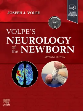 Volpe / Inder |  Volpe's Neurology of the Newborn | Buch |  Sack Fachmedien