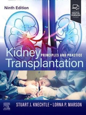 Knechtle / Marson |  Kidney Transplantation | Buch |  Sack Fachmedien