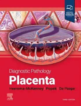 Heerema-McKenney / Popek / De Paepe |  Diagnostic Pathology: Placenta | Buch |  Sack Fachmedien