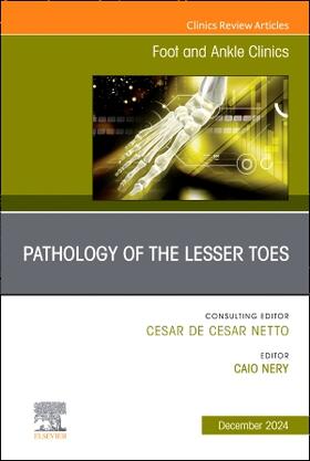 Nery |  Pathology of the Lesser Toes, an Issue of Foot and Ankle Clinics of North America | Buch |  Sack Fachmedien