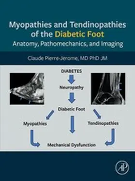 Pierre-Jerome |  Myopathies and Tendinopathies of the Diabetic Foot | eBook | Sack Fachmedien