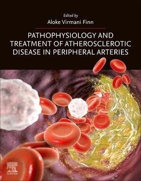 Finn |  Pathophysiology and Treatment of Atherosclerotic Disease in Peripheral Arteries | Buch |  Sack Fachmedien