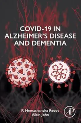 Reddy / John |  COVID-19 in Alzheimer's Disease and Dementia | eBook | Sack Fachmedien