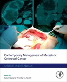 Ejaz / Pawlik MD |  Contemporary Management of Metastatic Colorectal Cancer | eBook | Sack Fachmedien