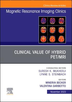 Becker / Garibotto |  Clinical Value of Hybrid Pet/Mri, an Issue of Magnetic Resonance Imaging Clinics of North America | Buch |  Sack Fachmedien