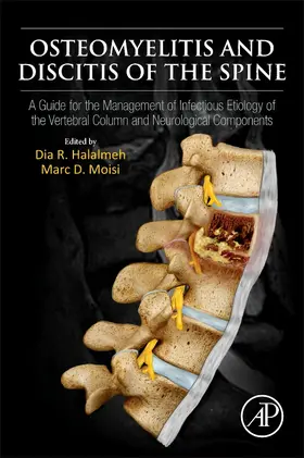 Halalmeh / Moisi |  Osteomyelitis and Discitis of the Spine | Buch |  Sack Fachmedien