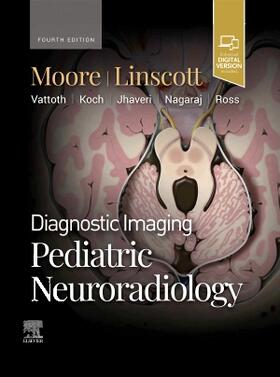 Moore / Linscott |  Diagnostic Imaging: Pediatric Neuroradiology | Buch |  Sack Fachmedien