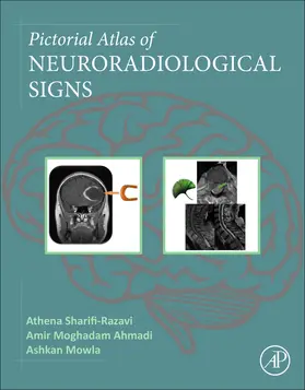 Sharifi-Razavi / Ahmadi / Mowla |  Pictorial Atlas of Neuroradiological Signs | Buch |  Sack Fachmedien