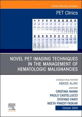Nanni / Castellucci / Fanti |  Novel Pet Imaging Techniques in the Management of Hematologic Malignancies, an Issue of Pet Clinics | Buch |  Sack Fachmedien