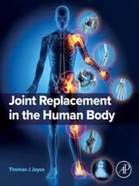 Joyce |  Joint Replacement in the Human Body | eBook | Sack Fachmedien