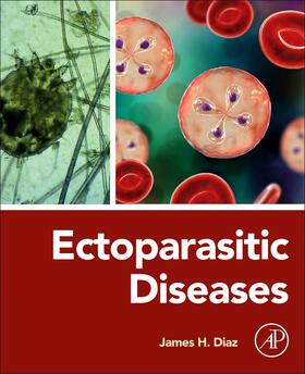 Diaz |  Ectoparasitic Diseases | Buch |  Sack Fachmedien
