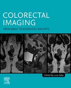 Saba MD / Saba | Colorectal Imaging | E-Book | sack.de