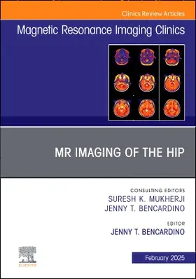 Bencardino |  MR Imaging of the Hip, an Issue of Magnetic Resonance Imaging Clinics of North America | Buch |  Sack Fachmedien