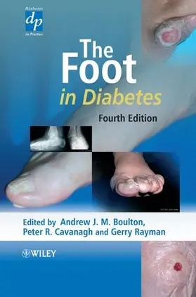 Boulton / Cavanagh / Rayman |  The Foot in Diabetes | Buch |  Sack Fachmedien