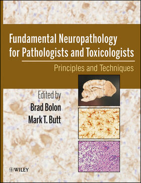 Bolon / Butt |  Fundamental Neuropathology for Pathologists and Toxicologists | Buch |  Sack Fachmedien