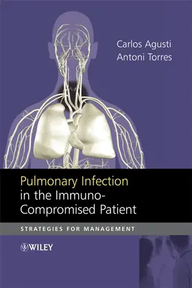 Agusti / Torres |  Pulmonary Infection in the Immunocompromised Patient | Buch |  Sack Fachmedien