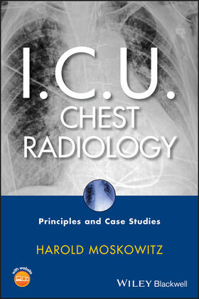 Moskowitz |  I.C.U. Chest Radiology | Buch |  Sack Fachmedien